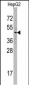 SNX6 Antibody (N-term)